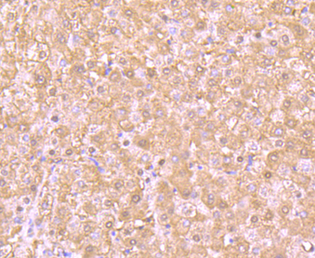 PSMB8 Recombinant Rabbit Monoclonal Antibody