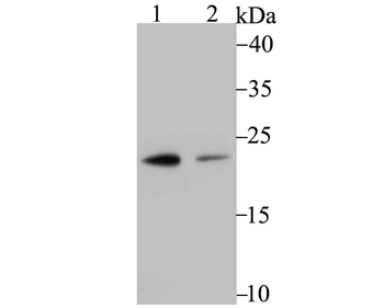 PSMB8 Recombinant Rabbit Monoclonal Antibody