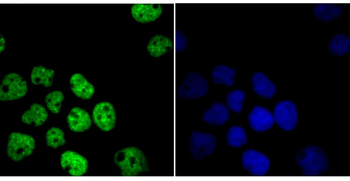 HDAC9 Recombinant Rabbit Monoclonal Antibody