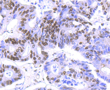 HDAC9 Recombinant Rabbit Monoclonal Antibody