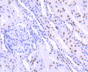 HDAC9 Recombinant Rabbit Monoclonal Antibody