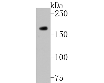 HDAC9 Recombinant Rabbit Monoclonal Antibody
