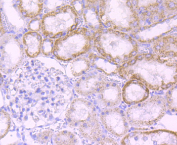 MMP3 Recombinant Rabbit Monoclonal Antibody