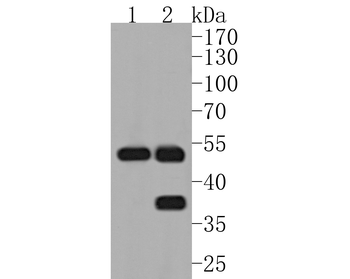 MMP3 Recombinant Rabbit Monoclonal Antibody