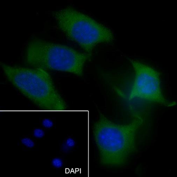 MMP3 Recombinant Rabbit Monoclonal Antibody
