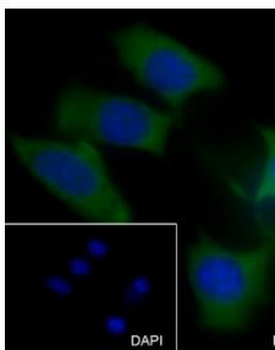 MMP3 Recombinant Rabbit Monoclonal Antibody