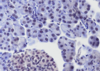 BMAL1 Recombinant Rabbit Monoclonal Antibody