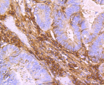 TGFBI Recombinant Rabbit Monoclonal Antibody
