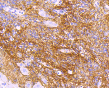 TGFBI Recombinant Rabbit Monoclonal Antibody