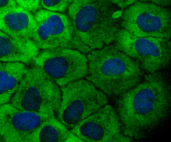 TAK1/MAP3K7 Recombinant Rabbit Monoclonal Antibody