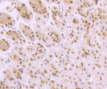 TAK1/MAP3K7 Recombinant Rabbit Monoclonal Antibody