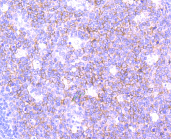 SNAP23 Recombinant Rabbit Monoclonal Antibody