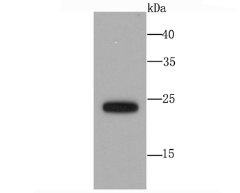 SNAP23 Recombinant Rabbit Monoclonal Antibody