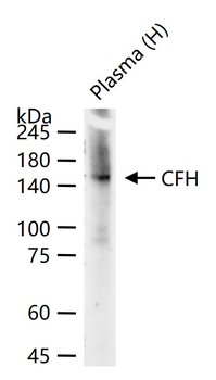 CFH Recombinant Rabbit Monoclonal Antibody