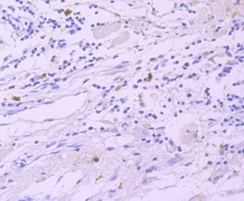 GATA1 Recombinant Rabbit Monoclonal Antibody