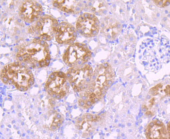 GATA1 Recombinant Rabbit Monoclonal Antibody