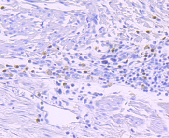 GATA1 Recombinant Rabbit Monoclonal Antibody