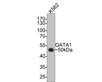GATA1 Recombinant Rabbit Monoclonal Antibody