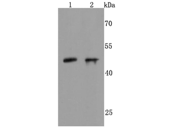 NEUROD1 Recombinant Rabbit Monoclonal Antibody