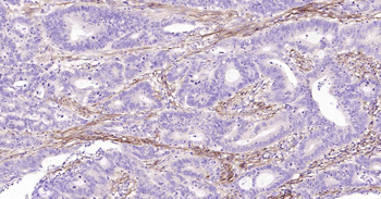 Podoplanin Recombinant Rabbit Monoclonal Antibody