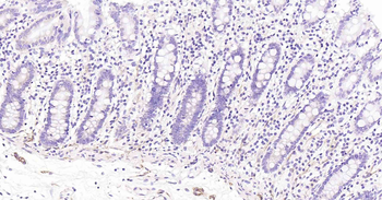 Podoplanin Recombinant Rabbit Monoclonal Antibody