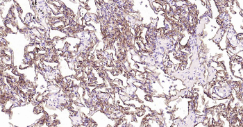 Podoplanin Recombinant Rabbit Monoclonal Antibody