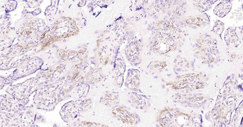 Podoplanin Recombinant Rabbit Monoclonal Antibody