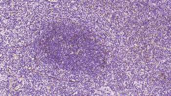 Podoplanin Recombinant Rabbit Monoclonal Antibody