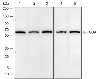 GBA Recombinant Rabbit Monoclonal Antibody
