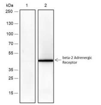 ADRB2 Recombinant Rabbit Monoclonal Antibody