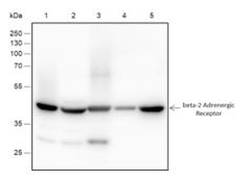 ADRB2 Recombinant Rabbit Monoclonal Antibody
