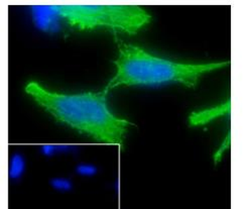 ADRB2 Recombinant Rabbit Monoclonal Antibody