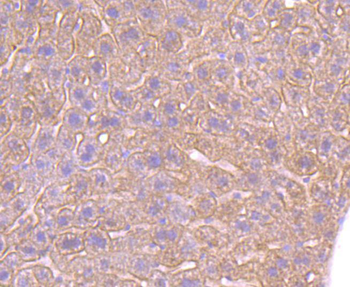 ADRB2 Recombinant Rabbit Monoclonal Antibody