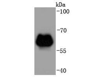 ADRB2 Recombinant Rabbit Monoclonal Antibody