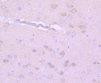 NF-H Recombinant Rabbit Monoclonal Antibody