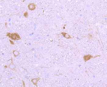 NF-H Recombinant Rabbit Monoclonal Antibody