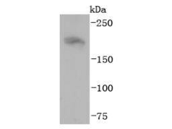 NF-H Recombinant Rabbit Monoclonal Antibody