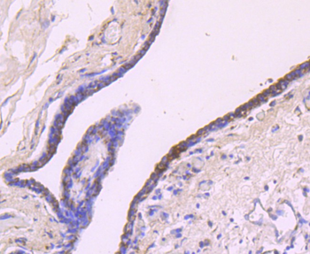 IGF2 Recombinant Rabbit Monoclonal Antibody