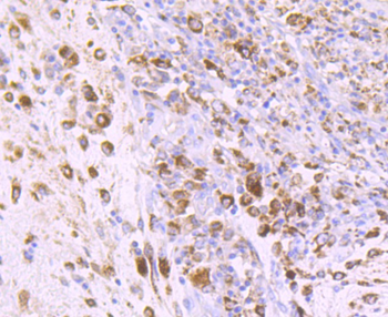 IGF2 Recombinant Rabbit Monoclonal Antibody