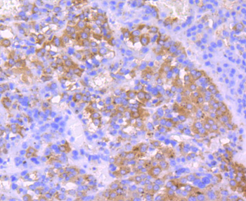 IGF2 Recombinant Rabbit Monoclonal Antibody