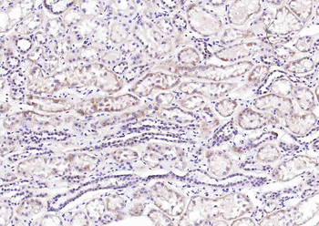 IGF2 Recombinant Rabbit Monoclonal Antibody