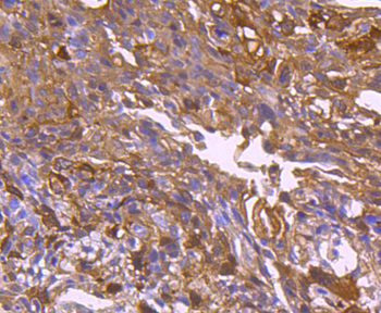 Hsp27 Recombinant Rabbit Monoclonal Antibody