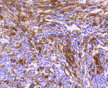 Hsp27 Recombinant Rabbit Monoclonal Antibody