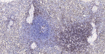 CD3D Recombinant Rabbit Monoclonal Antibody