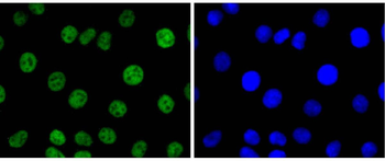 PAX8 Recombinant Rabbit Monoclonal Antibody