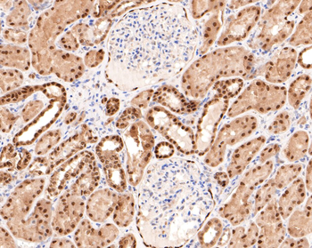 PAX8 Recombinant Rabbit Monoclonal Antibody