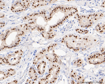 PAX8 Recombinant Rabbit Monoclonal Antibody