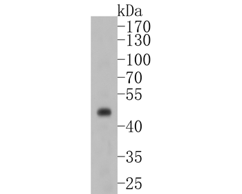 PAX8 Recombinant Rabbit Monoclonal Antibody