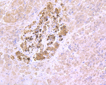 PAX6 Recombinant Rabbit Monoclonal Antibody