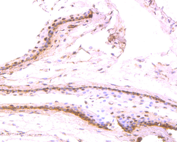 PAX6 Recombinant Rabbit Monoclonal Antibody
